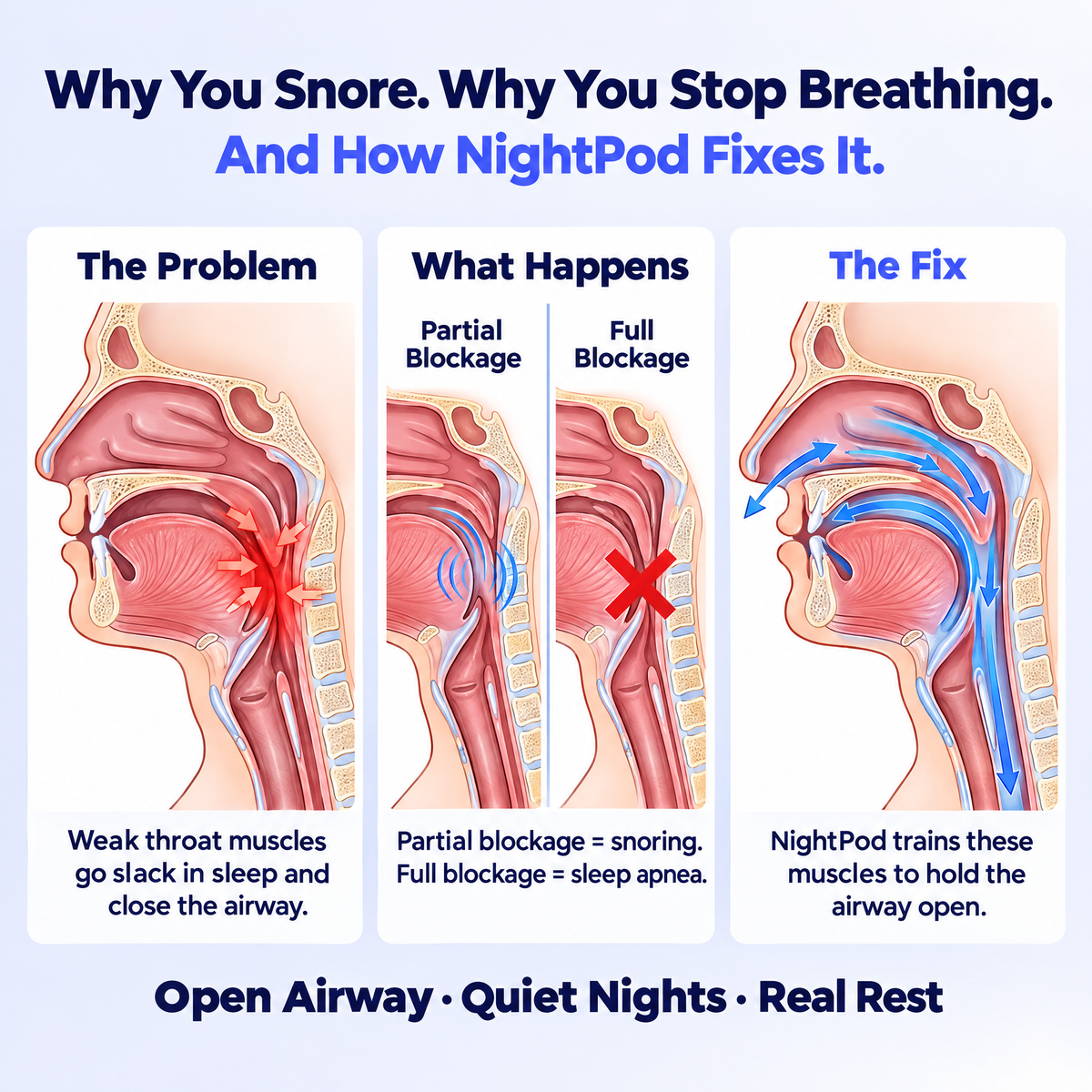 Why you snore and how NightPod fixes it