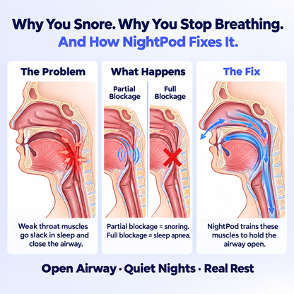 Why you snore and how NightPod fixes it